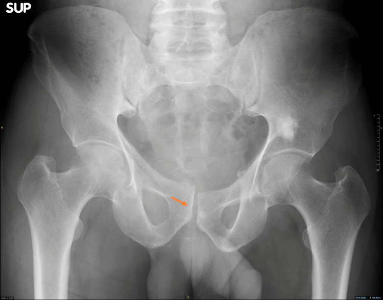 Figure 13