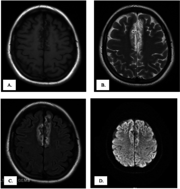 FIGURE 1
