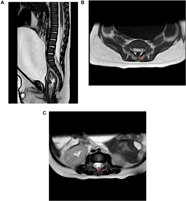 Figure 2