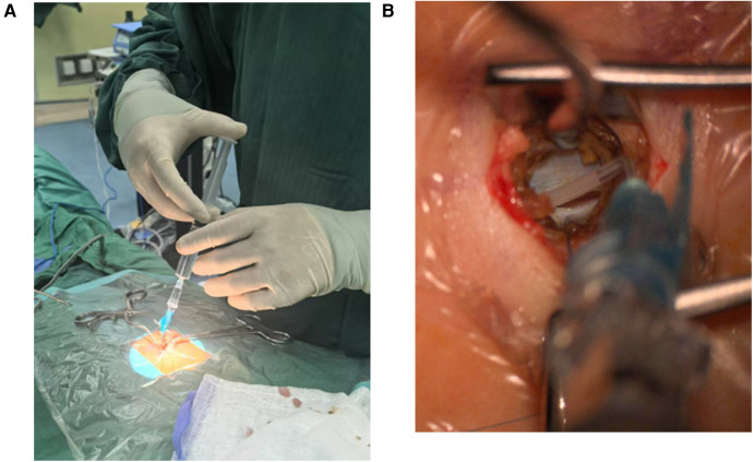 Figure 3