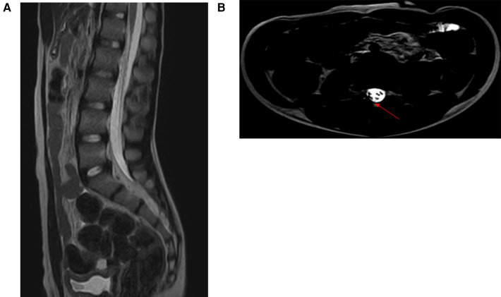 Figure 4