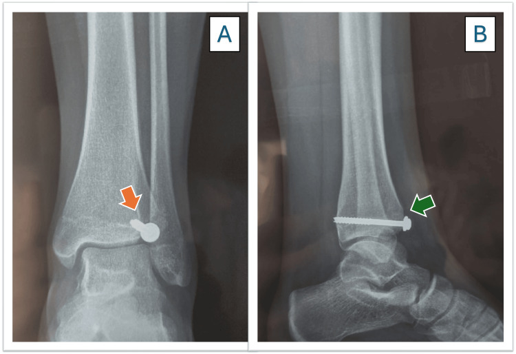 Figure 6
