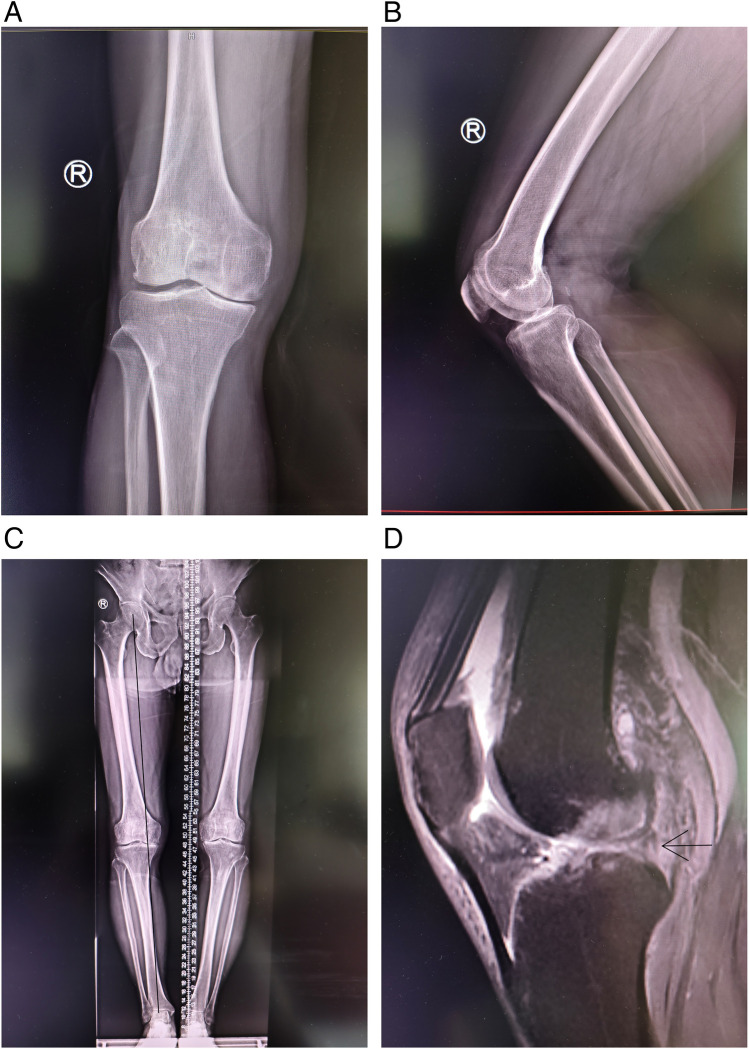 Figure 1