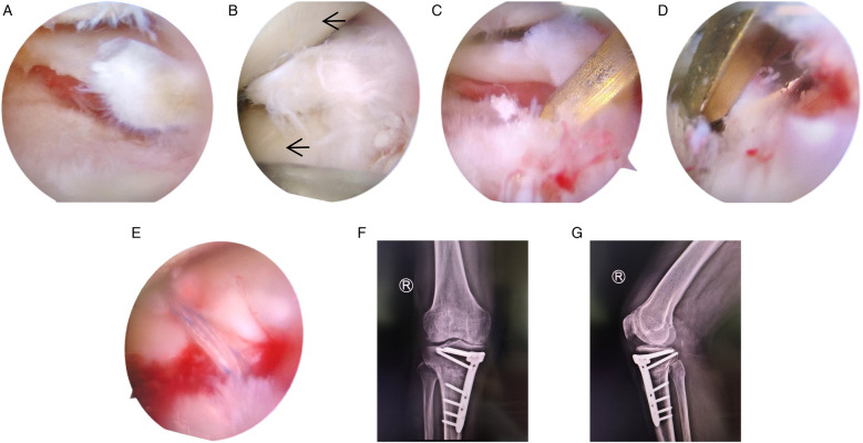 Figure 2
