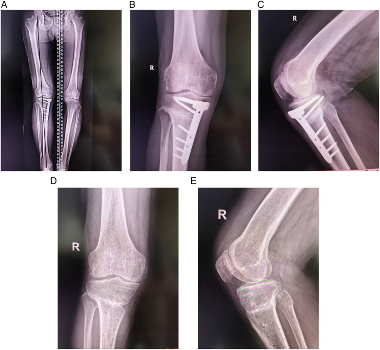 Figure 3