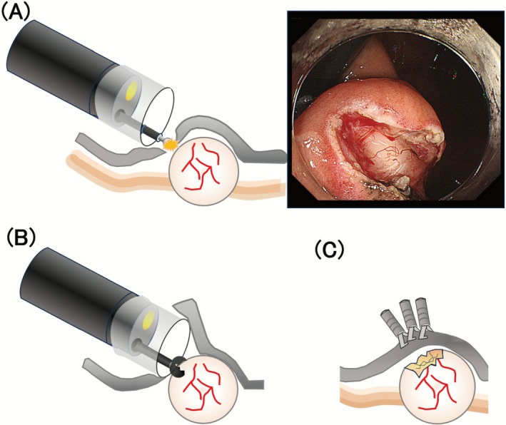 FIGURE 4