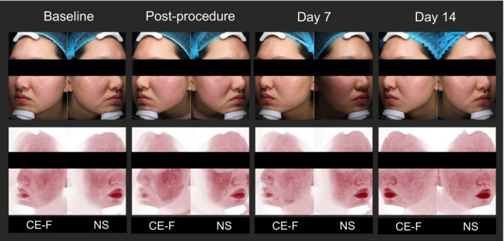 FIGURE 3
