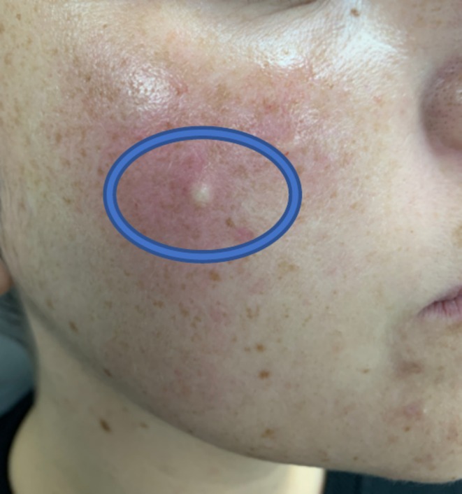FIGURE 1