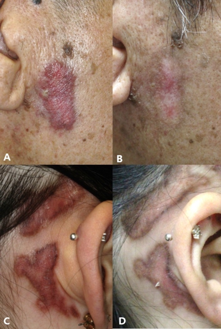 FIGURE 3