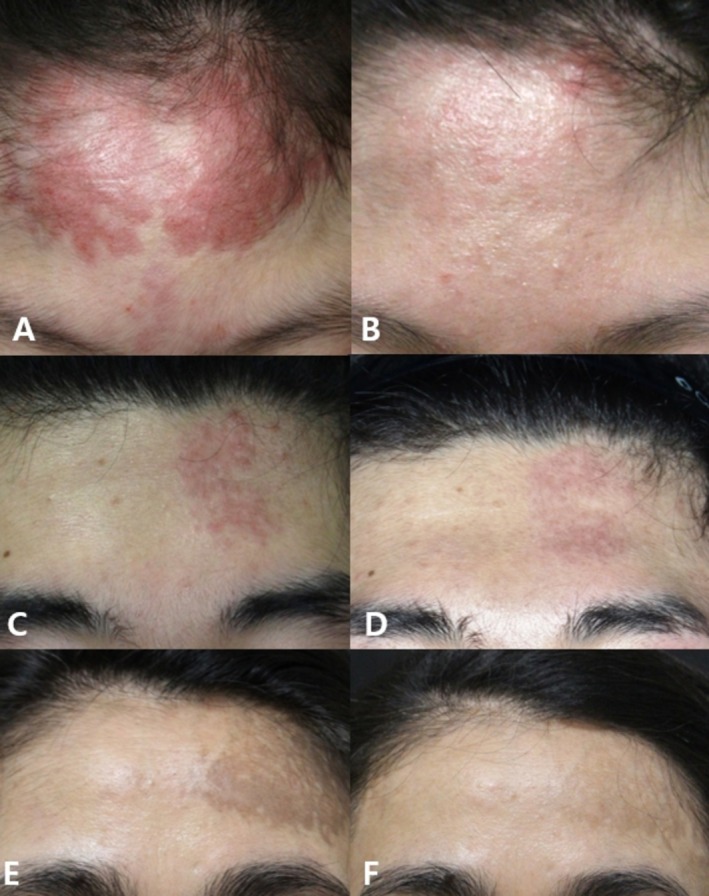 FIGURE 6