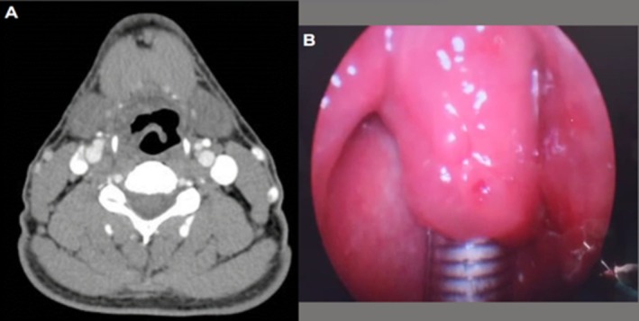 FIGURE 3