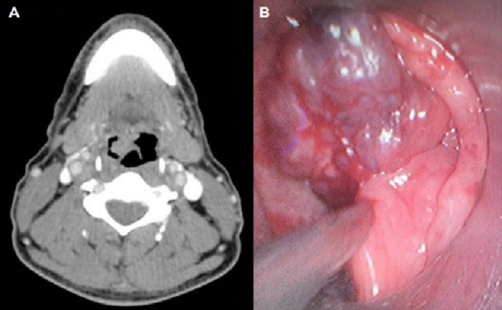 FIGURE 1