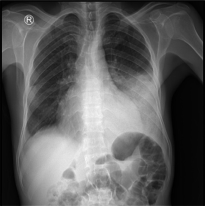 FIGURE 1