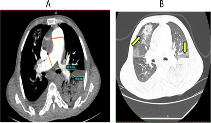 FIGURE 2