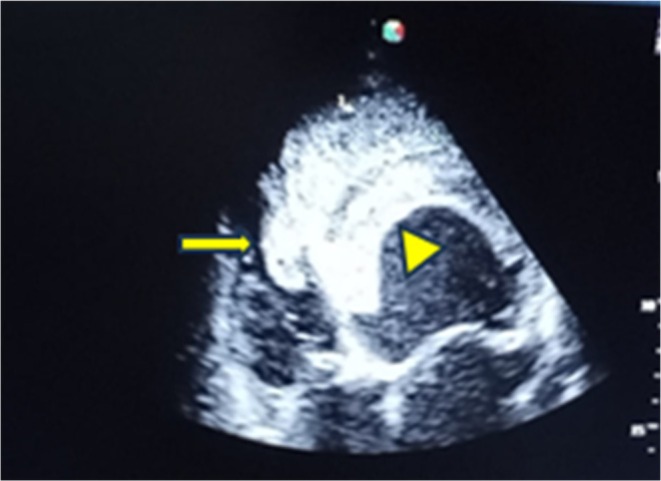 FIGURE 3