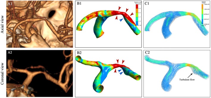 FIGURE 3