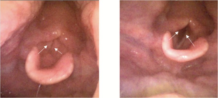 FIGURE 3