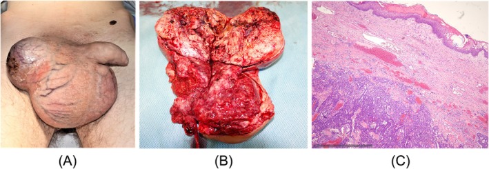 FIGURE 3
