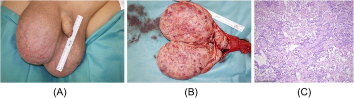FIGURE 4