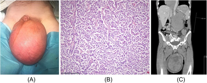 FIGURE 1