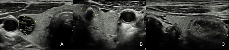 Figure 11