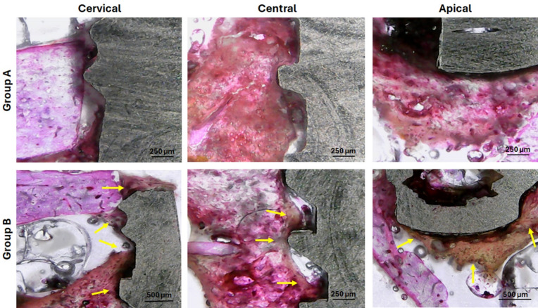 Figure 14