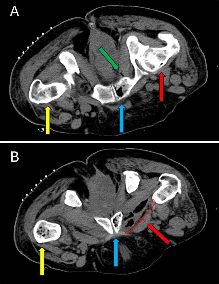 Figure 6