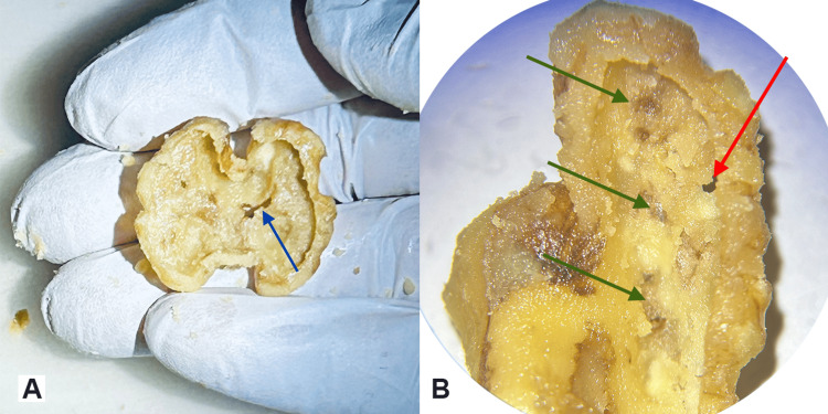 Figure 7