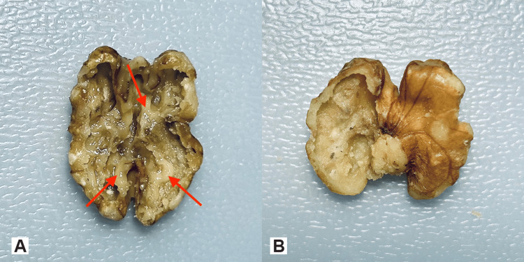 Figure 9