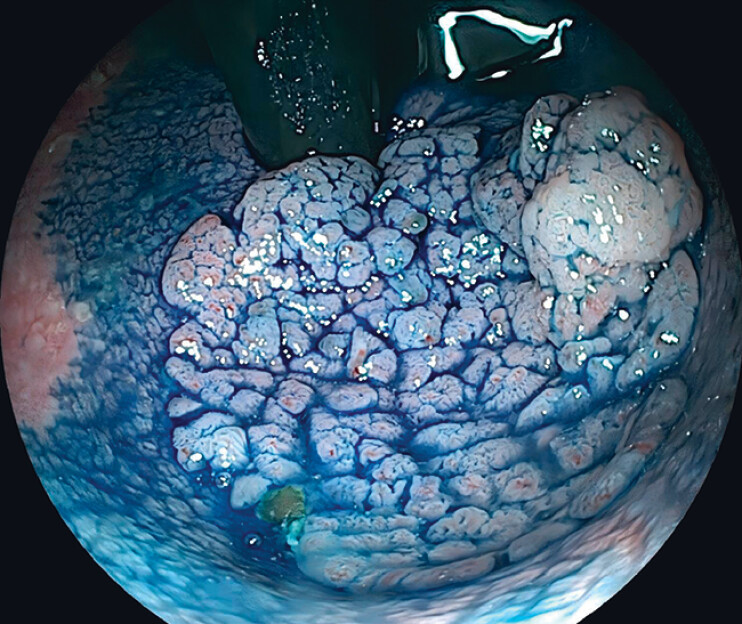 Fig. 2