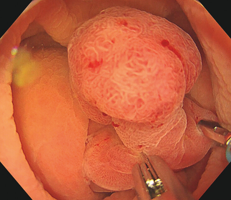 Fig. 3