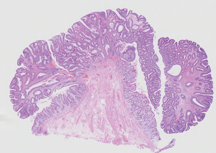Fig. 5