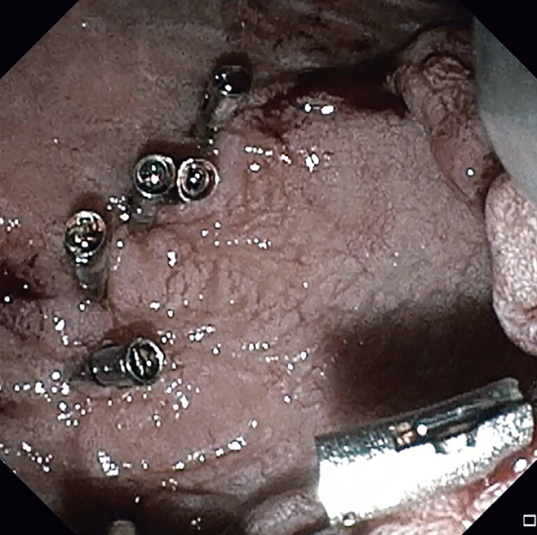 Fig. 4