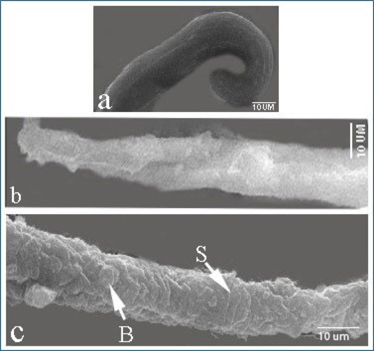 Figure 14