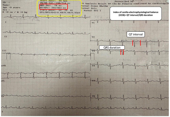 FIGURE 2