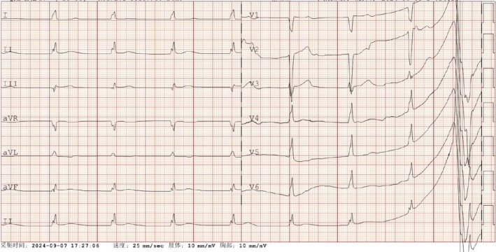 FIGURE 3