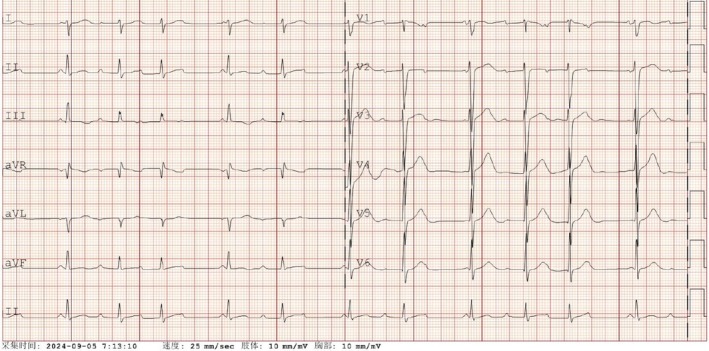 FIGURE 2