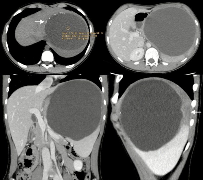 FIGURE 2