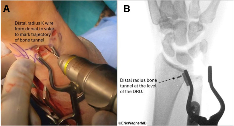 Figure 6