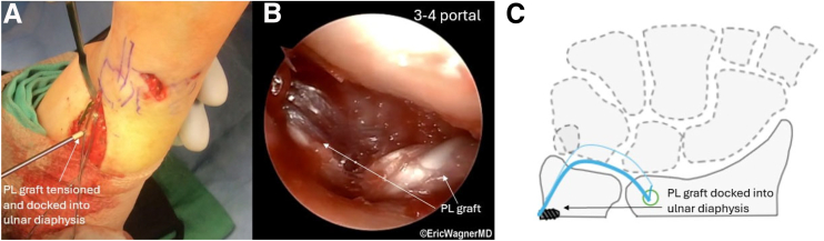 Figure 9