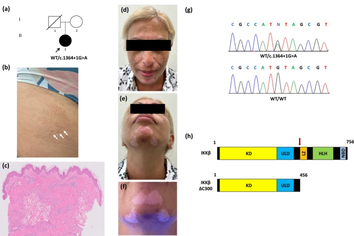 FIGURE 1