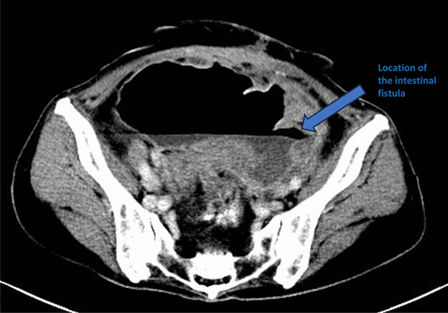 Figure 3