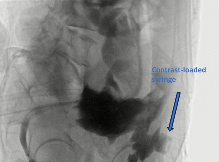 Figure 4