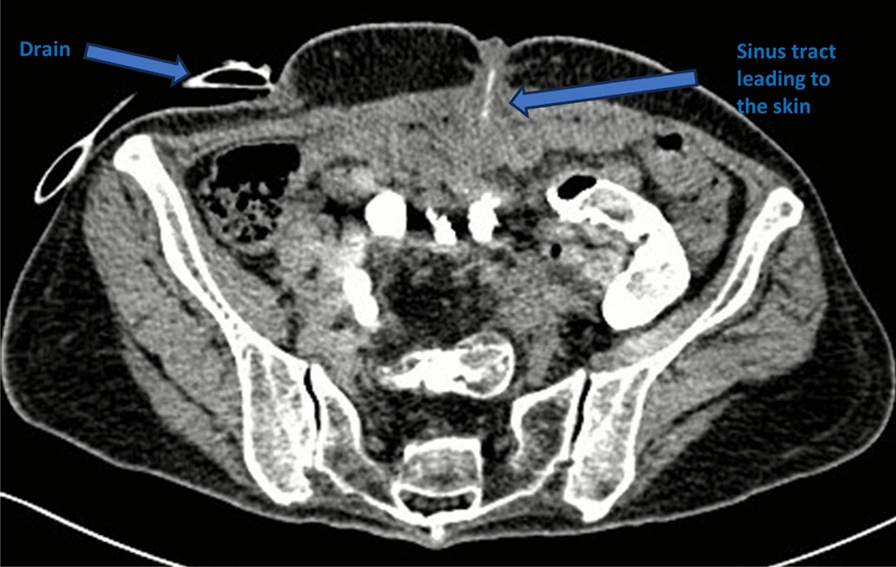 Figure 5