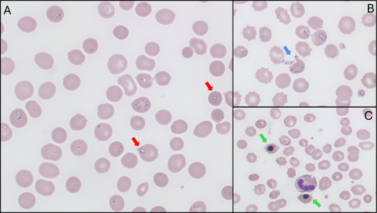 Fig 1
