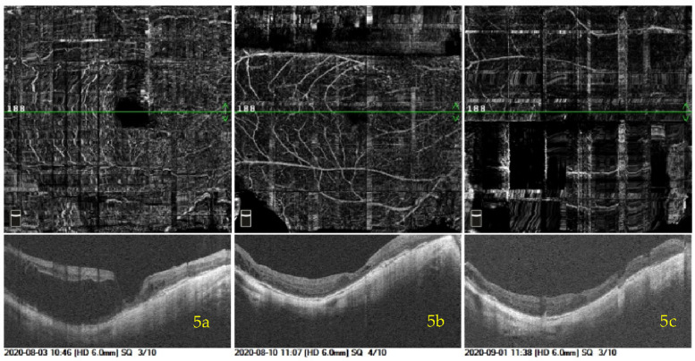 Figure 5