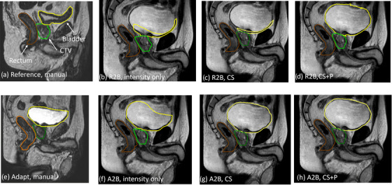 FIGURE 4