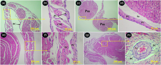 FIGURE 11