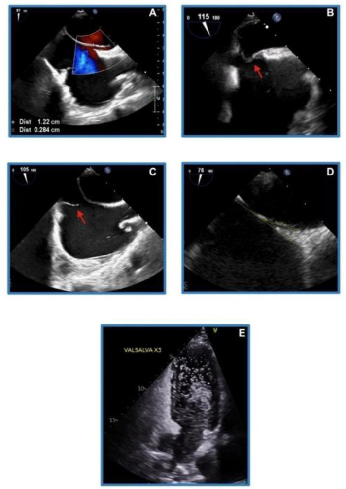 Figure 5