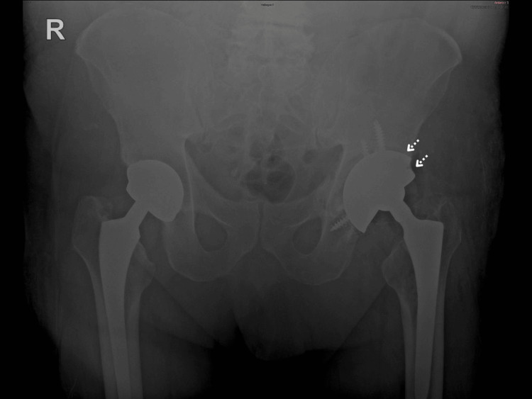 Figure 5